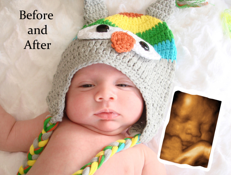 Baby belly spa coupons