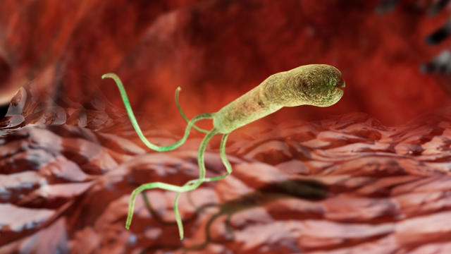 helicobacter-pylori