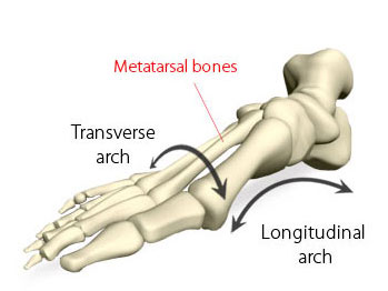 transverse2