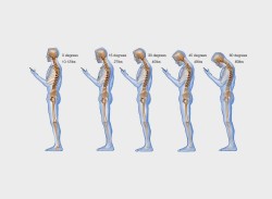 Backcare
